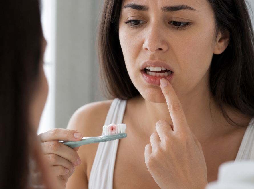 Gum Disease - Signs