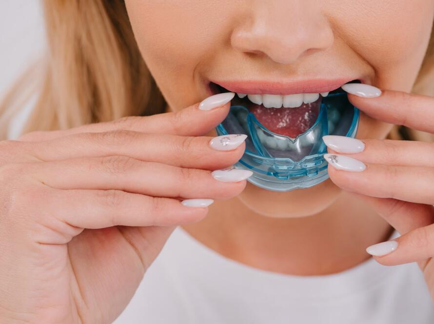 Mouthguard
